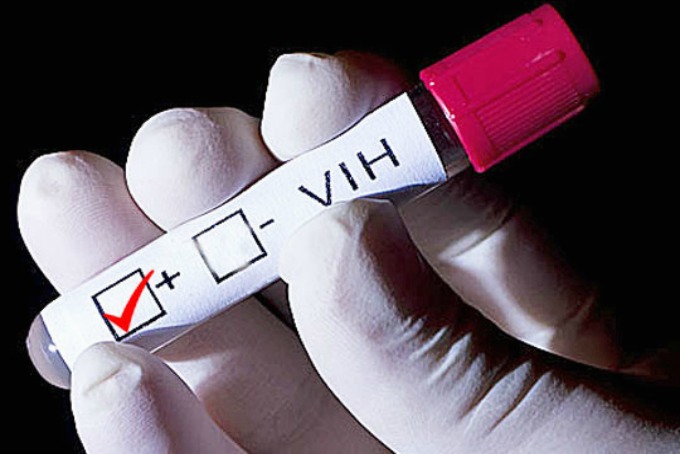 Diseñan un chip que detecta el VIH en la primera semana de infección
