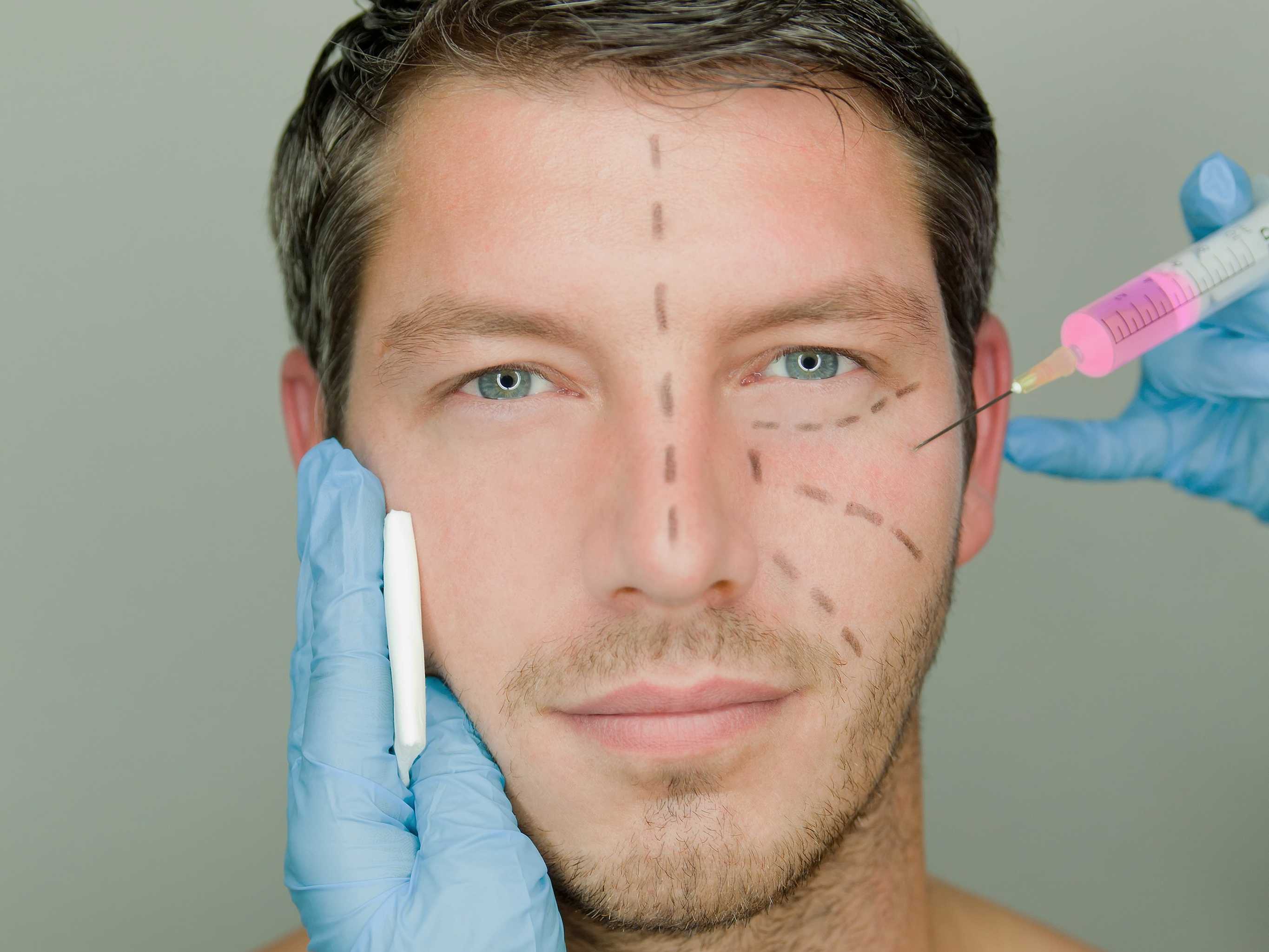 En aumento número de hombres practicándose cirugías estéticas