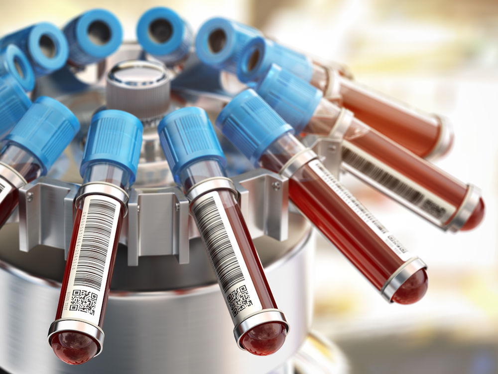Costo de análisis de Coronavirus en hospitales Dominicanos
